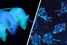 Cancer Cells Transformed into Harmless Fat: Breast Cancer Cells Becoming Fat Cells.