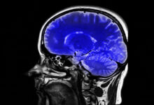 The Power Of The Placebo Effect