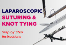 Fundamentals Of Laparoscopic Suturing And Knot Tying