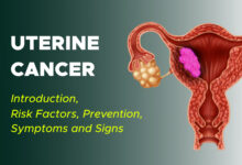 Uterine Cancer Introduction, Risk Factors, Prevention, Symptoms and Signs