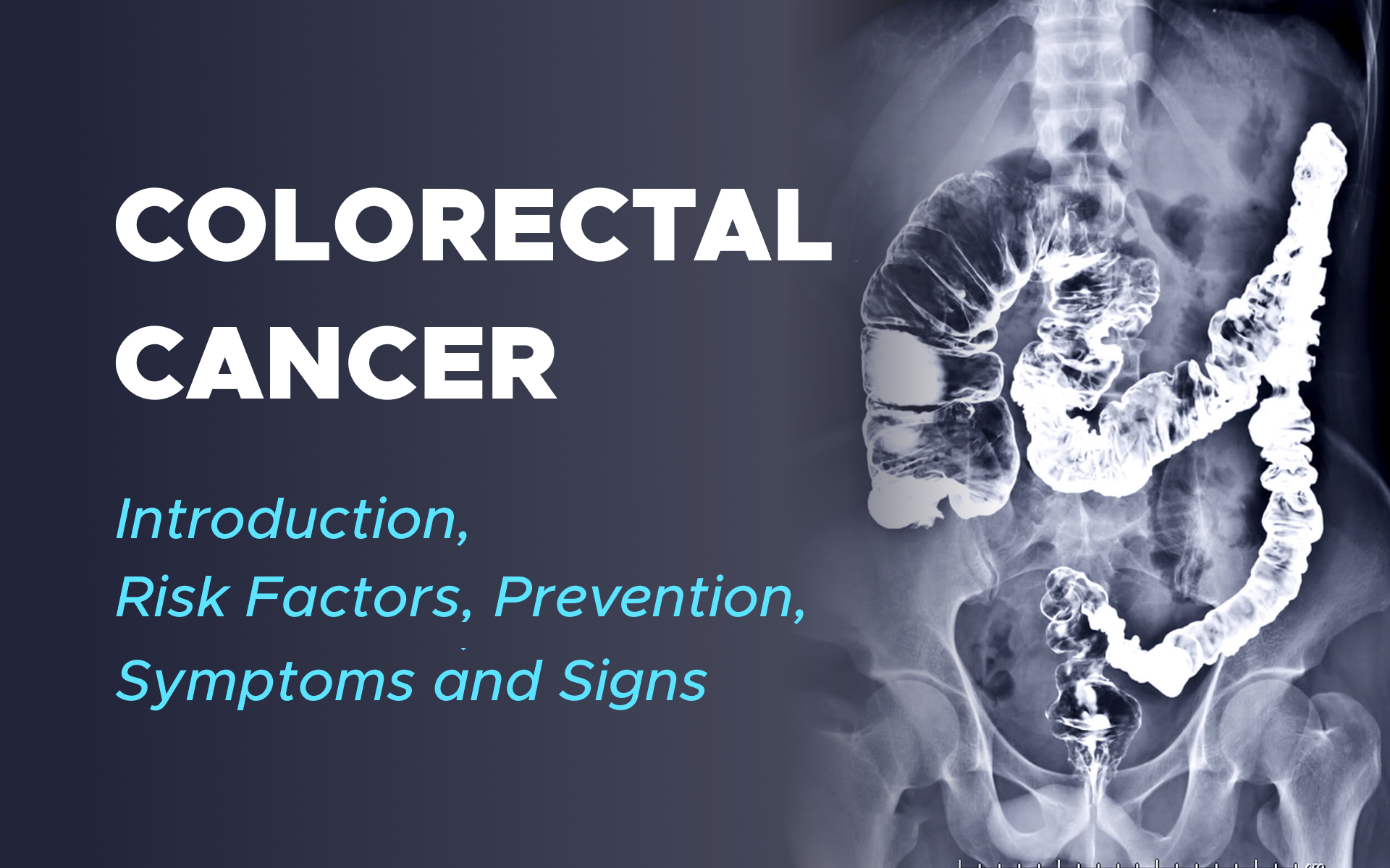 Colorectal Cancer Introduction, Risk Factors, Prevention, Symptoms and Signs