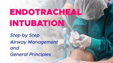 Step by Step Endotracheal Intubation Airway Management and General Principles