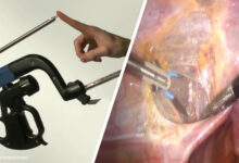New Surgical Robot allows Surgeons to “Feel” their way with a Haptic Feedback System