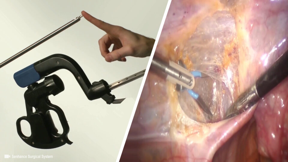New Surgical Robot allows Surgeons to “Feel” their way with a Haptic Feedback System