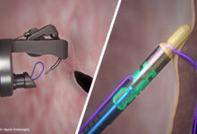 Single Channel Endoscopic Suturing System