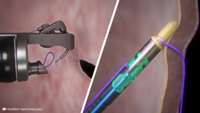 Single Channel Endoscopic Suturing System