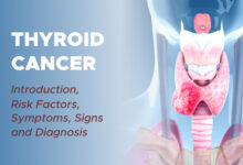 Thyroid Cancer: Introduction, Risk Factors, Symptoms, Signs and Diagnosis