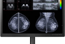 Cutting-Edge 31-inch 12 Megapixel Display Solutions for PACS and Breast Imaging FDA Cleared