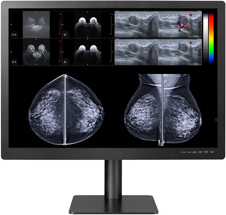 Cutting-Edge 31-inch 12 Megapixel Display Solutions for PACS and Breast Imaging FDA Cleared