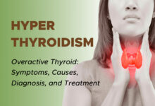 Hyperthyroidism: Overactive Thyroid: Symptoms, Causes, Diagnosis, Treatment