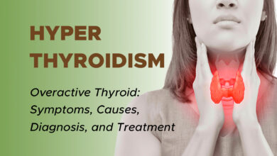 Hyperthyroidism: Overactive Thyroid: Symptoms, Causes, Diagnosis, Treatment