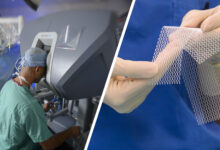 Robotic Ventral Hernia Repair with Mesh Placement