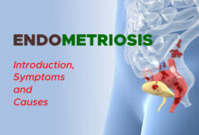 Endometriosis: Introduction, Symptoms and Causes