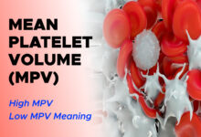 Understanding Mean Platelet Volume (MPV) Blood Test: High MPV, Low MPV Meaning