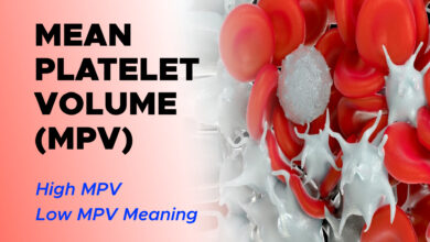 Understanding Mean Platelet Volume (MPV) Blood Test: High MPV, Low MPV Meaning
