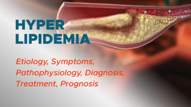 Hyperlipidemia: Etiology, Pathophysiology, Symptoms, Diagnosis, Treatment, Prognosis