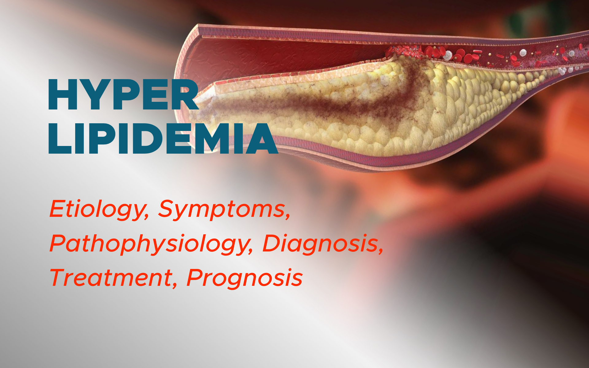 Hyperlipidemia: Etiology, Pathophysiology, Symptoms, Diagnosis, Treatment, Prognosis
