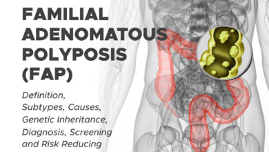 Familial Adenomatous Polyposis (FAP)