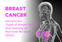 Breast Cancer: