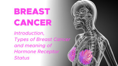Breast Cancer: