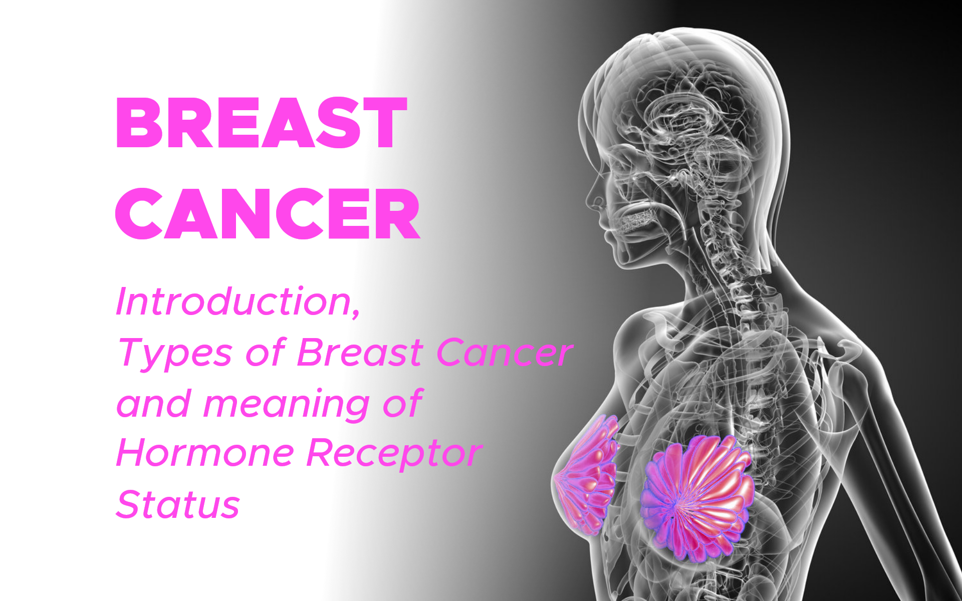Breast Cancer:
