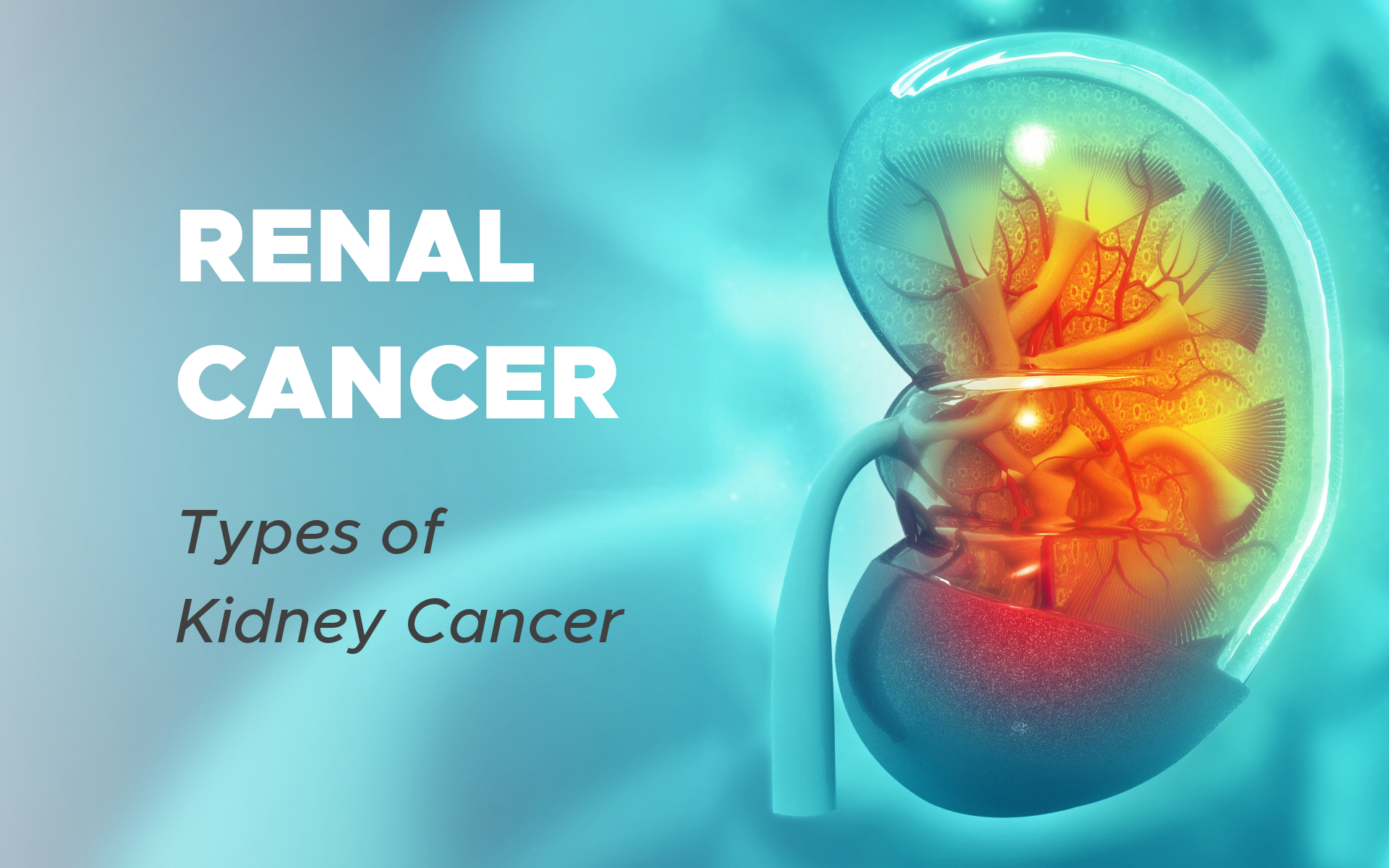 Renal Cancer: Types of Kidney Cancer