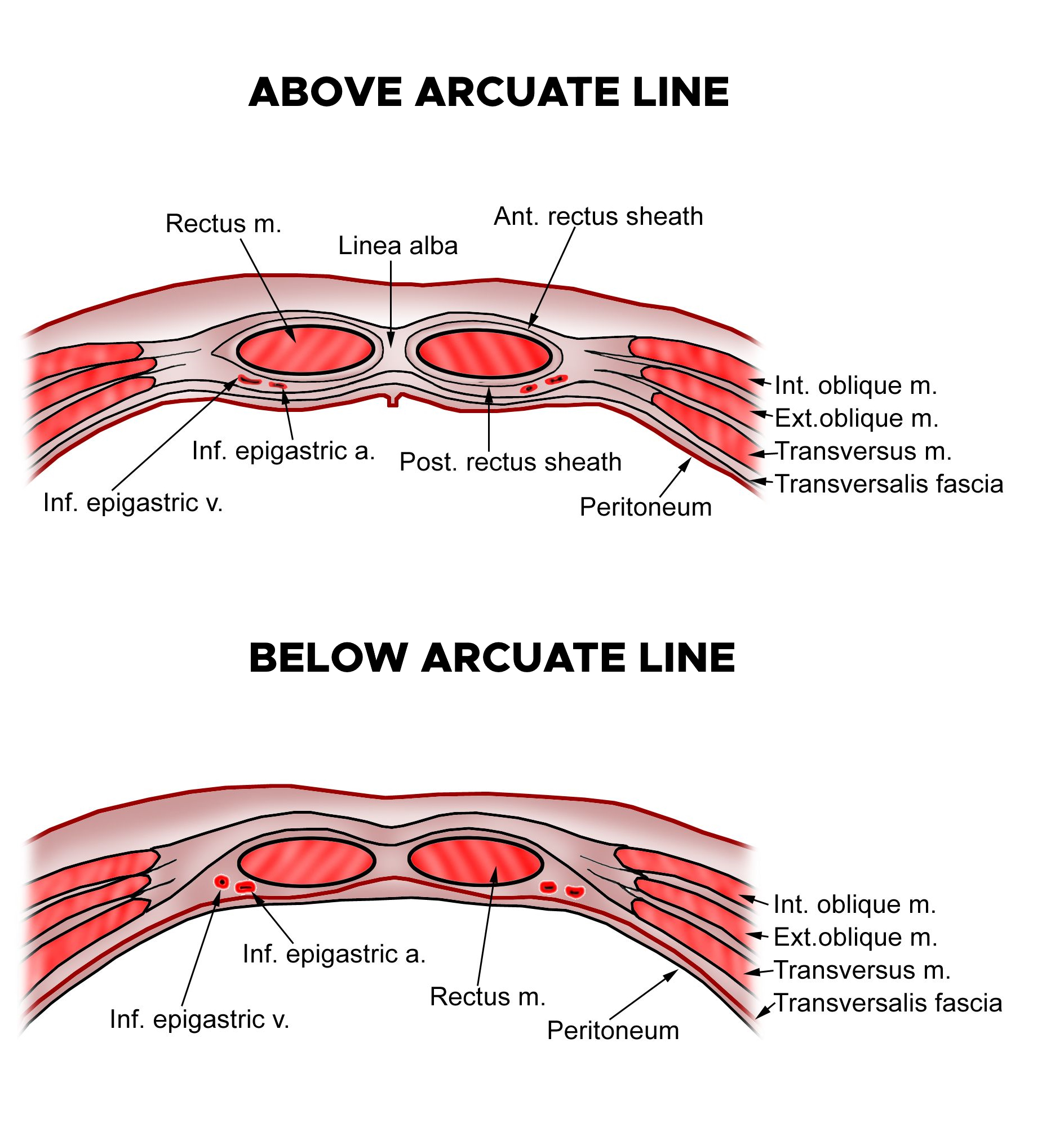 Abdominal Incisions and Anatomy of the Abdominal Wall Rectus Sheath