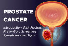 Prostate Cancer: Introduction, Risk Factors, Prevention, Screening, Symptoms and Signs