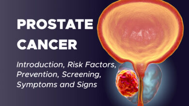 Prostate Cancer: Introduction, Risk Factors, Prevention, Screening, Symptoms and Signs