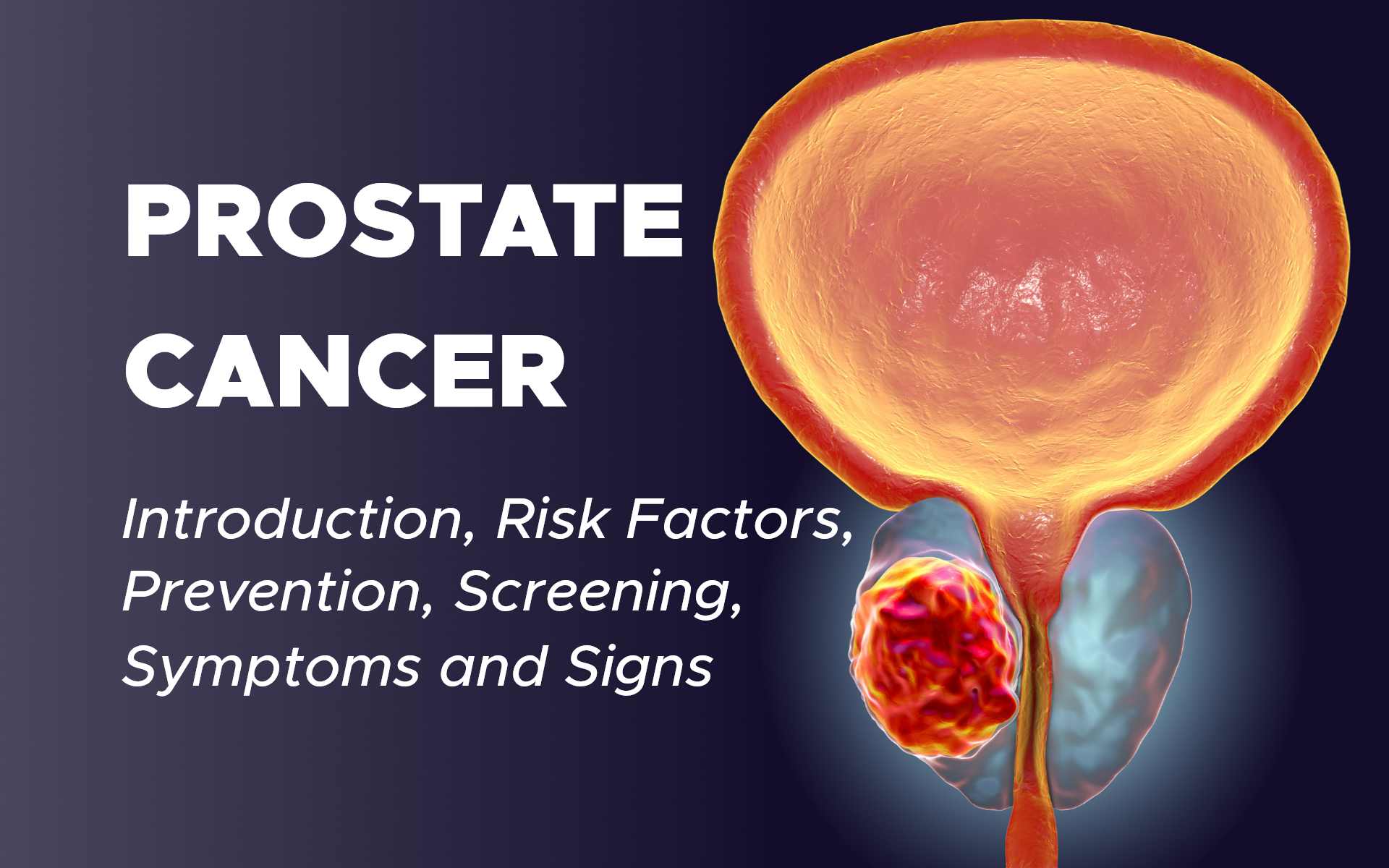 Prostate Cancer: Introduction, Risk Factors, Prevention, Screening, Symptoms and Signs