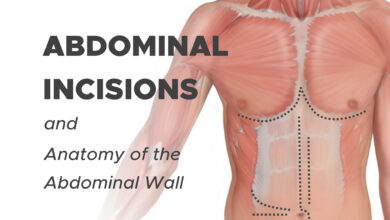 Types of Abdominal Incisions: Midline, Paramedian, Transverse and Oblique Incisions