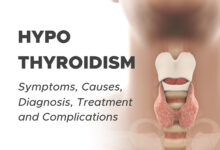 Hypothyroidism (Underactive Thyroid): Symptoms, Causes, Diagnosis, Treatment and Complications