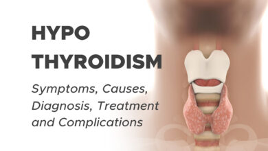 Hypothyroidism (Underactive Thyroid): Symptoms, Causes, Diagnosis, Treatment and Complications
