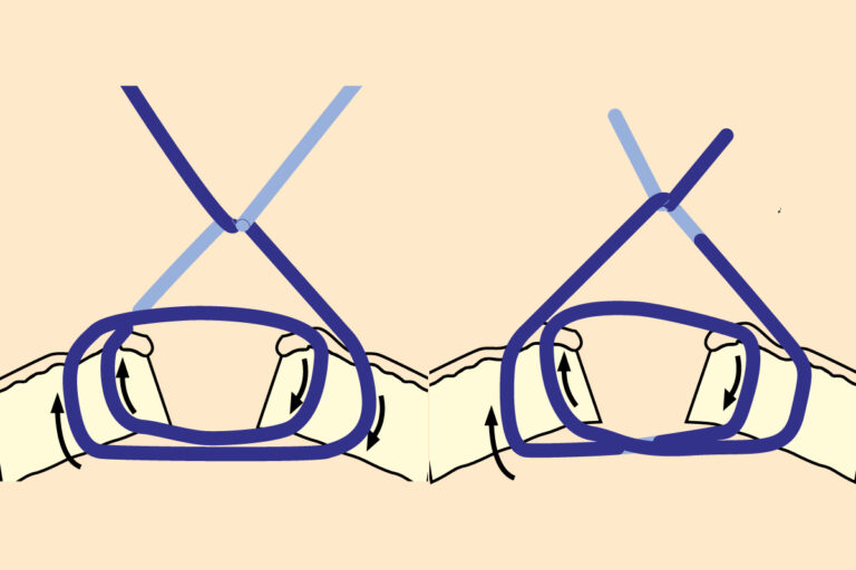 Common Suture Patterns - GynecolOncol