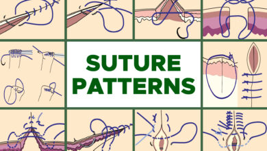 Common Suture Patterns: Interrupted, Continuous, Appositional, Inverting, Tension and Others