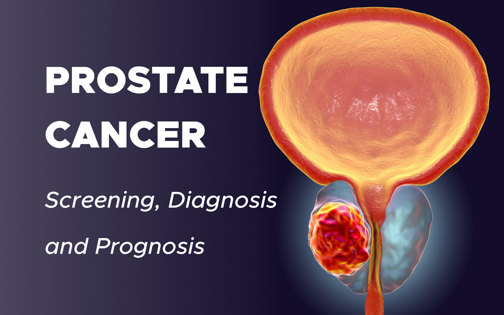 Prostate Cancer: Screening, Diagnosis and Prognosis