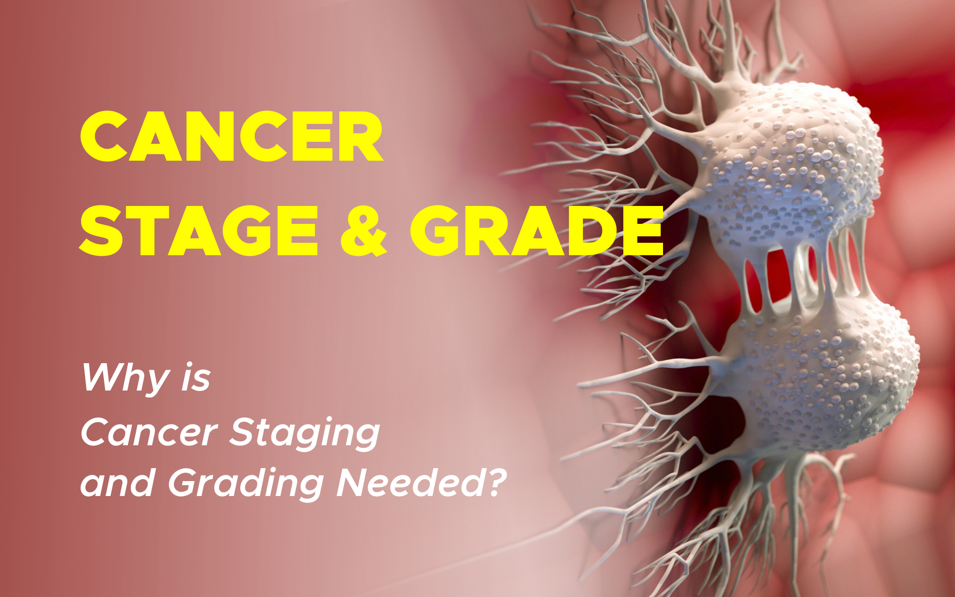 Cancer Grade vs. Cancer Stage