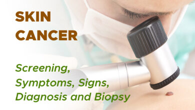 Non Melanoma Skin Cancer: Screening, Symptoms, Signs, Diagnosis and Biopsy