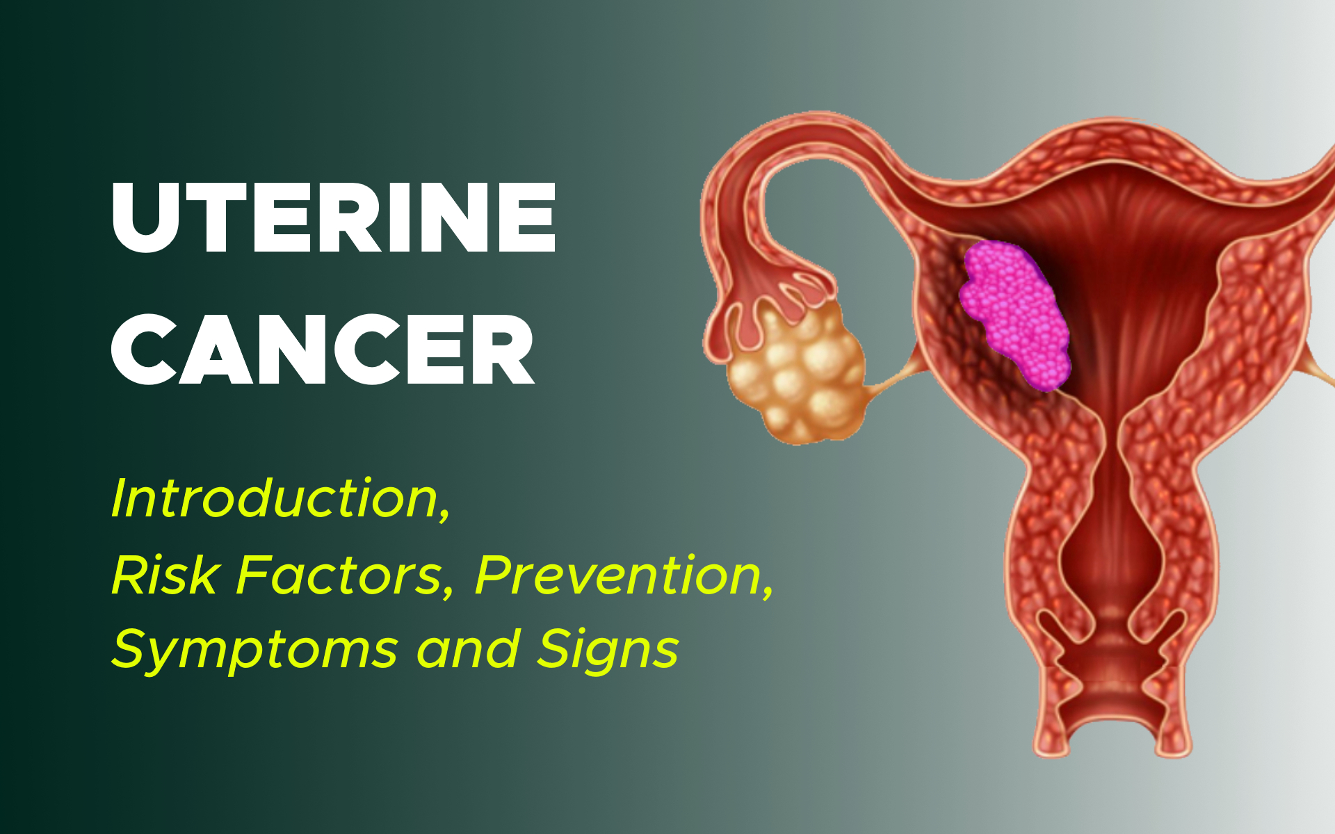 Uterine Cancer Introduction, Risk Factors, Prevention, Symptoms and Signs