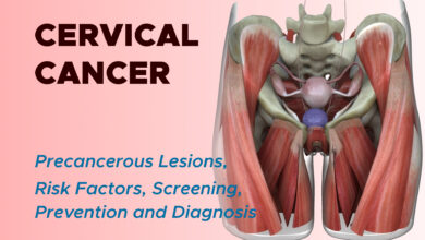 Cervical Cancer: Risk Factors, Screening, Prevention and Diagnosis