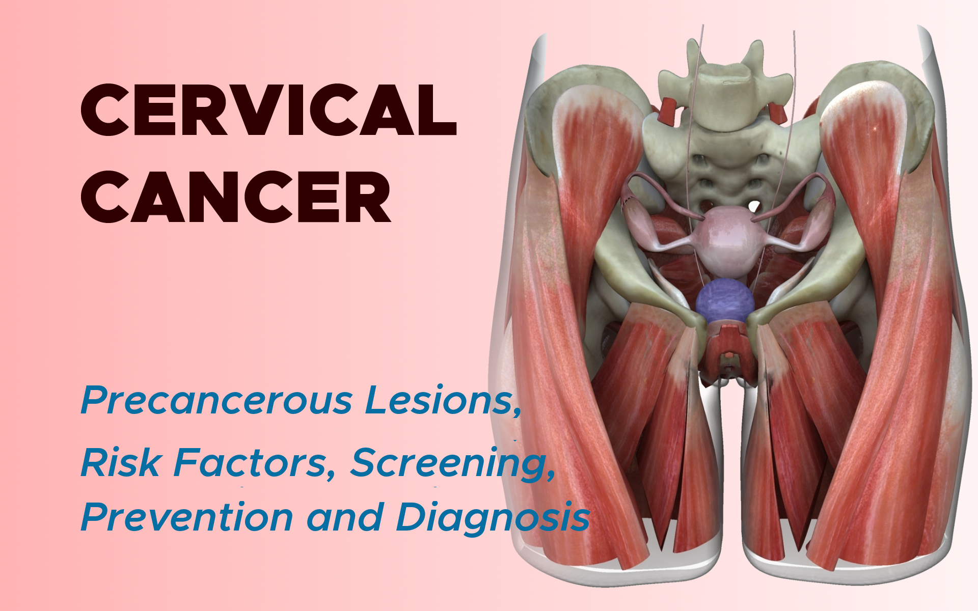 Cervical Cancer: Risk Factors, Screening, Prevention and Diagnosis